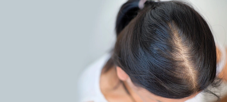 Hair Thinning Treatment: 8 Simple Tips to Make Hair Shiny and Full Again