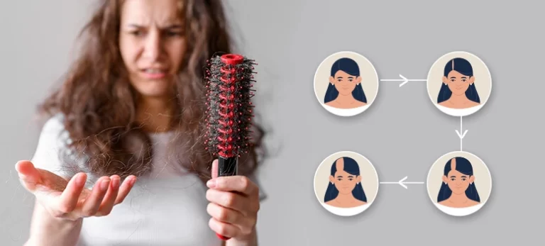 How does Minoxidil Help in hair growth