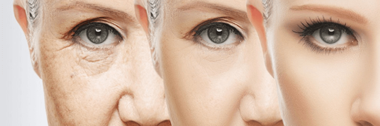 2 Effective Anti-Aging Treatments For Your 30s For You To Look Young And Healthy