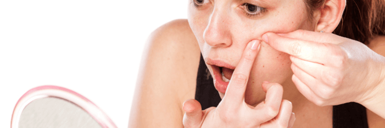 Acne – Ignorance Can Lead To Complications