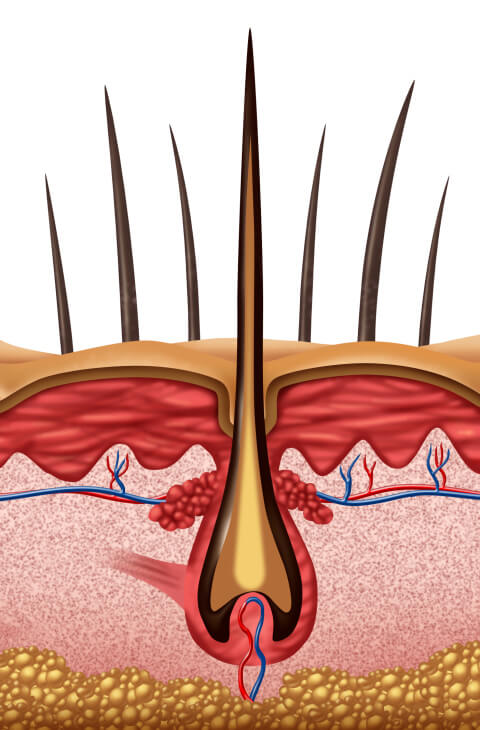 alopecia-in-men