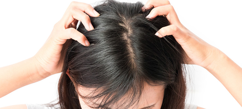 10 Reasons Why Your Scalp Is Itching