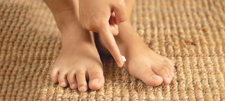 Athlete's Foot: 10 Myths and Facts