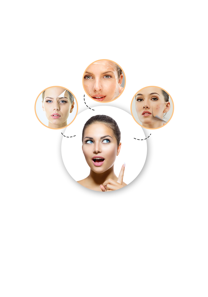 What Is a Chemical Peel?