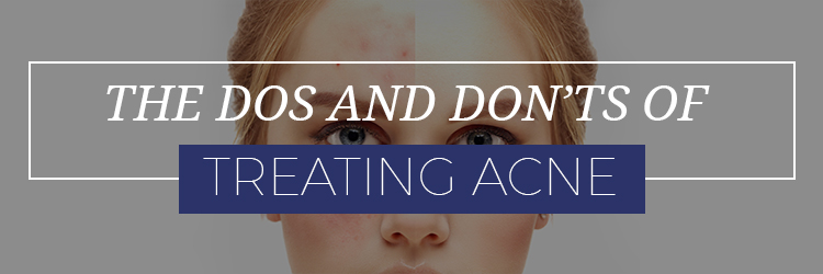 The Do's And Don'ts Treating Acne