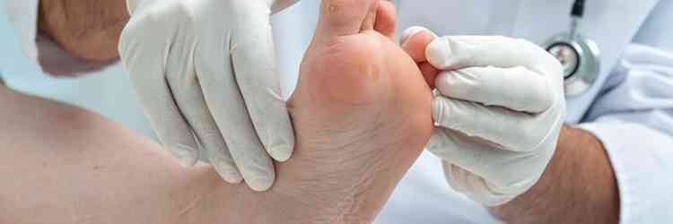 Find out How Your Dermatologist Can Help Cure Athlete’s Foot