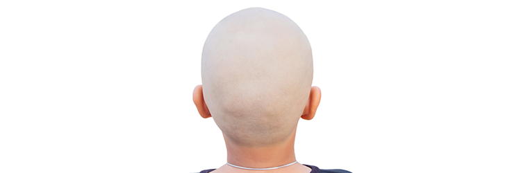 hair loss in children and their prevention