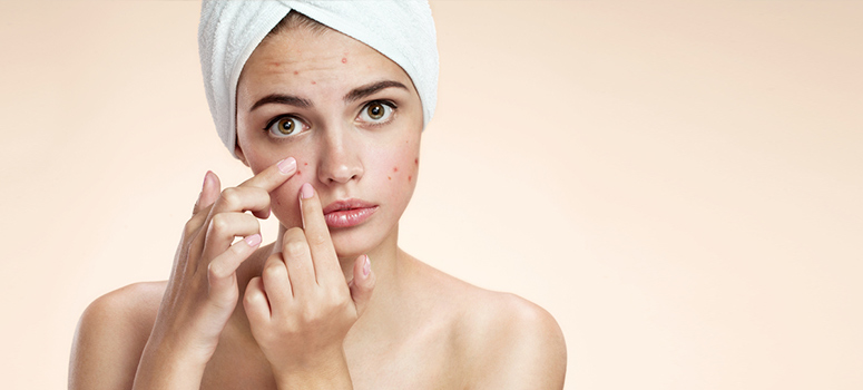 Adult Acne in Women: What's Triggering Your Breakouts?