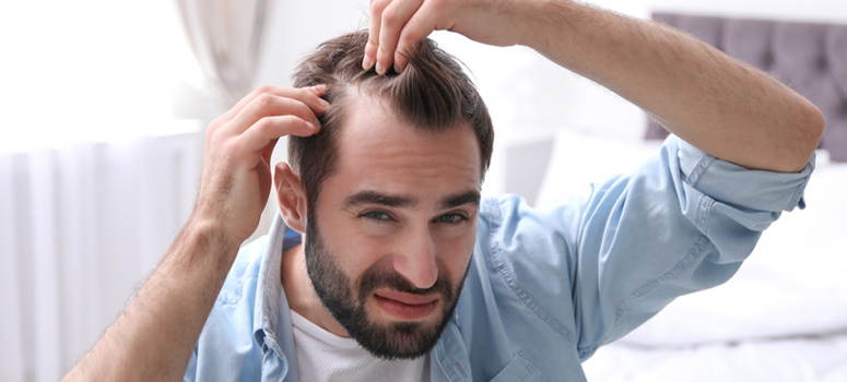 Early Signs of Hair Loss and Ways to Fight it
