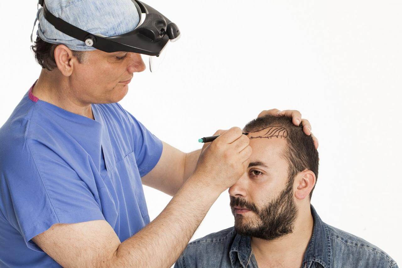 hair transplant treatment