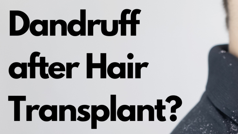 Is it normal to have dandruff after hair transplant treatment?
