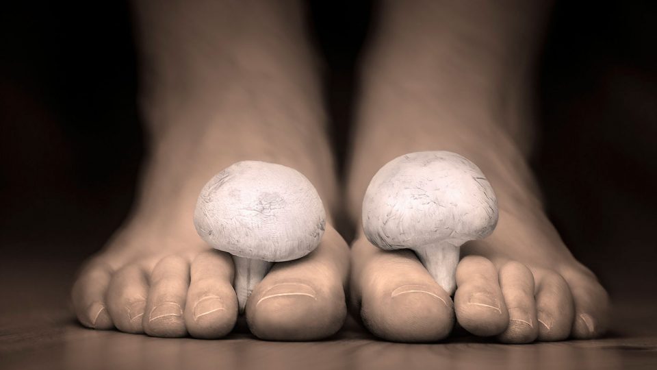 5 Dermat-Approved Ways to Treat Athlete’s Foot
