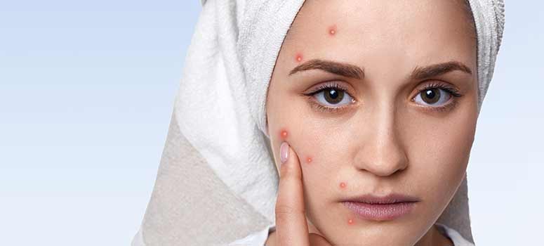 Bacterial Infections Of The Skin