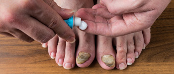 Symptoms-of-Nail-Fungus-Infection