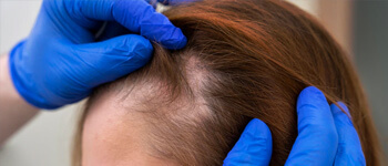 Treats Hair Disorders
