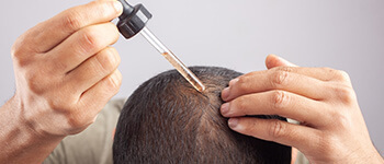 How to Use Minoxidil for Hair Loss and Hair Growth?