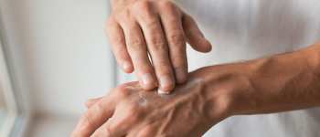 Treatment for Contact Dermatitis