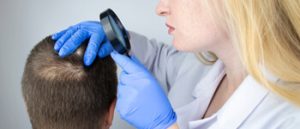 Diagnosing-Alopecia-Areata