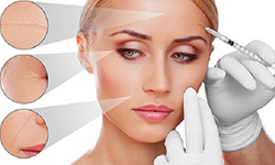 Hyaluronic_acid_based_fillers