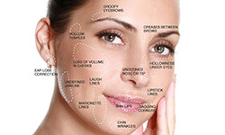 Collagen_based_fillers