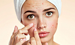 skin-problem-acne 