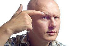 Alopecia-Universalis