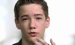 Are teenagers more affected by acne?