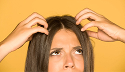 Home Remedies For An Itchy Scalp