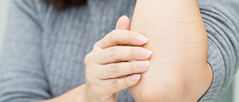 Can Atopic Dermatitis be permanently cured?