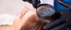 Criteria-for-hair-restoration