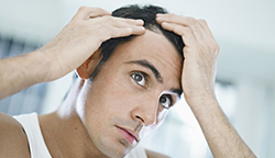 Expectations And Recovery after Hair Transplant for Men