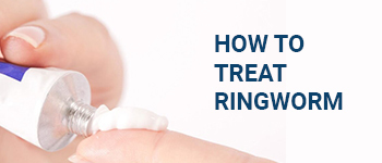 How_to_Treat_Ringworm