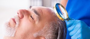 Importance-of-hair-restoration-techniques