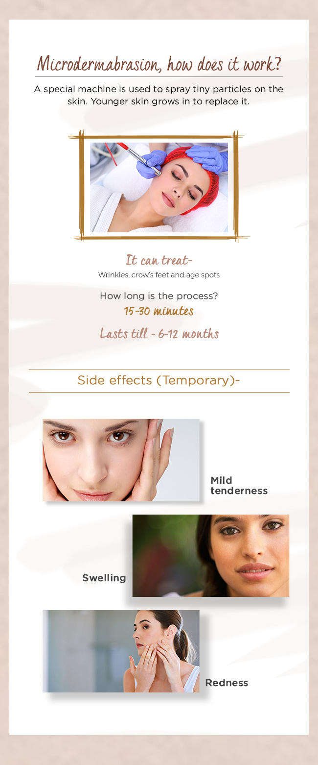Microdermabrasion__how_does_it_work