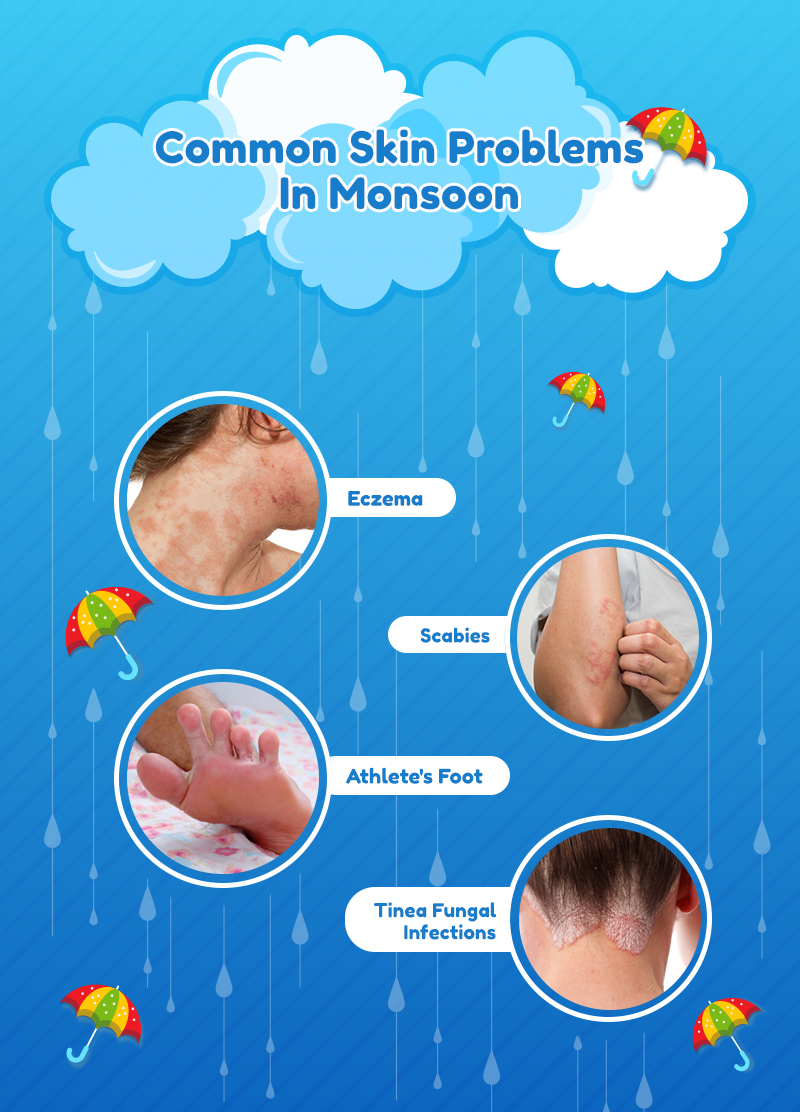 Common Skin Problems In Monsoon