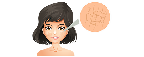 Dry or Itchy skin - signs of premature skin ageing