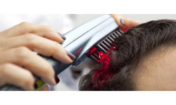 Laser Therapy - Hair Fall Solution for Women