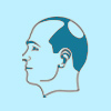 MALE PATTERN BALDNESS