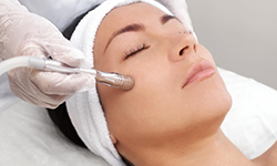 Microdermabrasion - Tan Removal Treatment