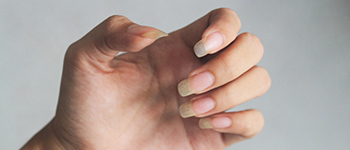 Pale Nails - Common Nail Problems