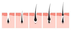 Phases-of-hair-growth