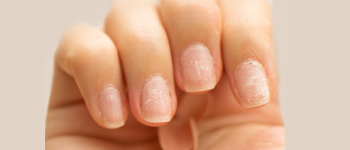 Pitted or Rippled Nails - Common Nail Problems