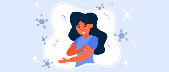 What is Psoriasis?