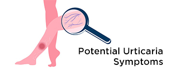 Potential Urticaria Symptoms