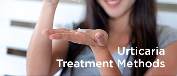 Urticaria Treatment Methods