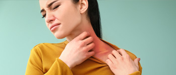 Some of the common symptoms of eczema