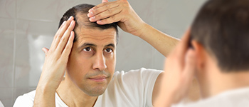 Telogen Effluvium - Stress-Related Hair Loss