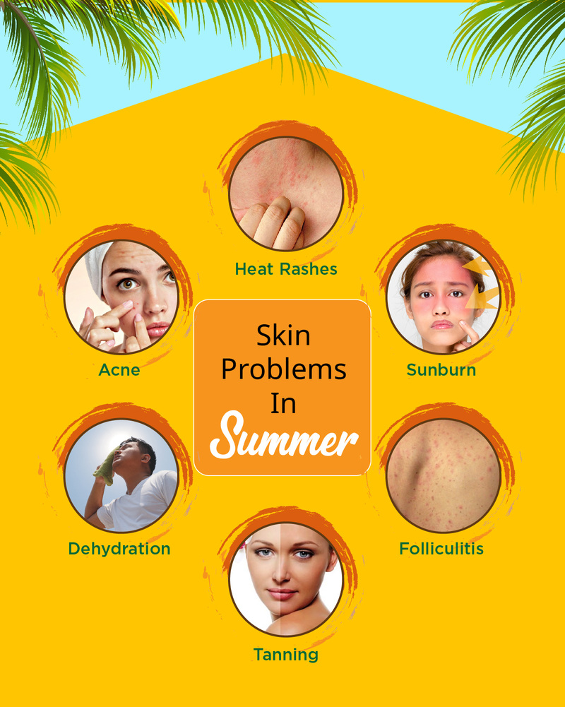 Skin Problems in Summer, Tips to Handle