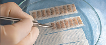 What Happens to Hair Grafts during Transplantation?