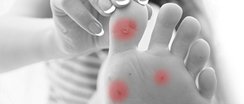What-are-the-symptoms-of-common-warts